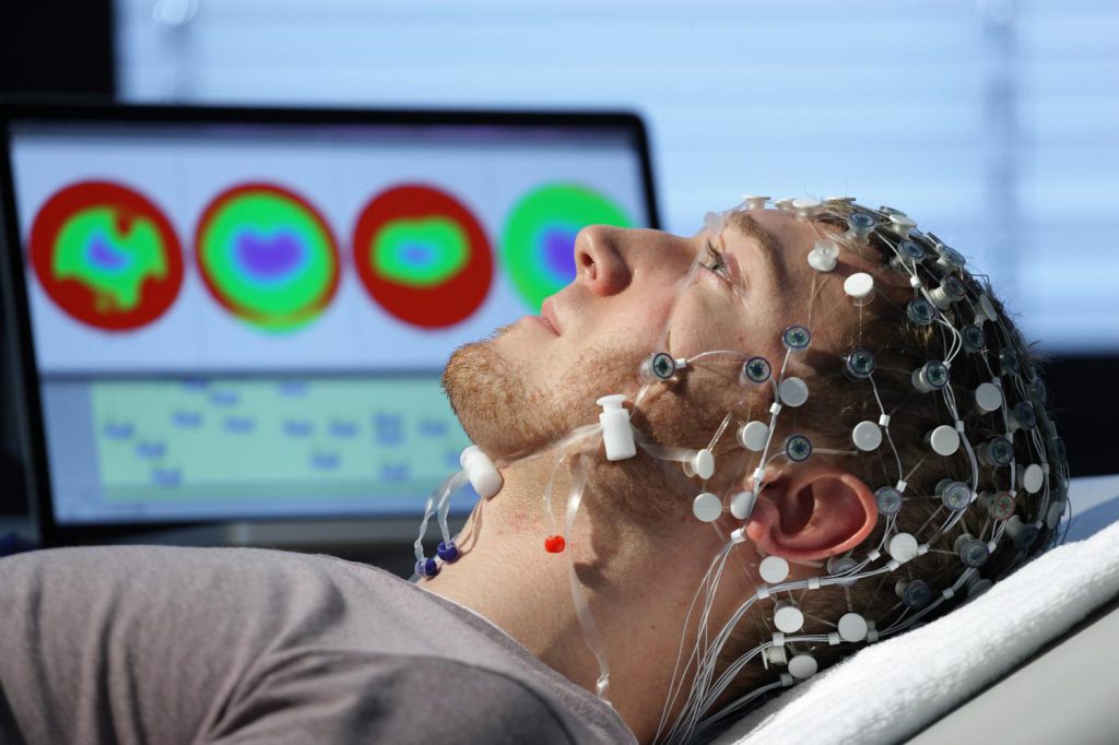 پردازش سیگنال EEG
